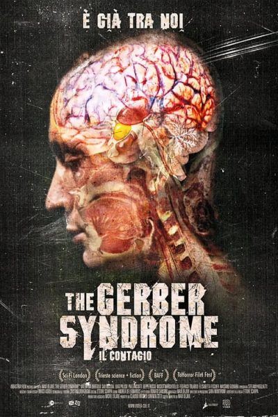 The Gerber Syndrome – Il contagio